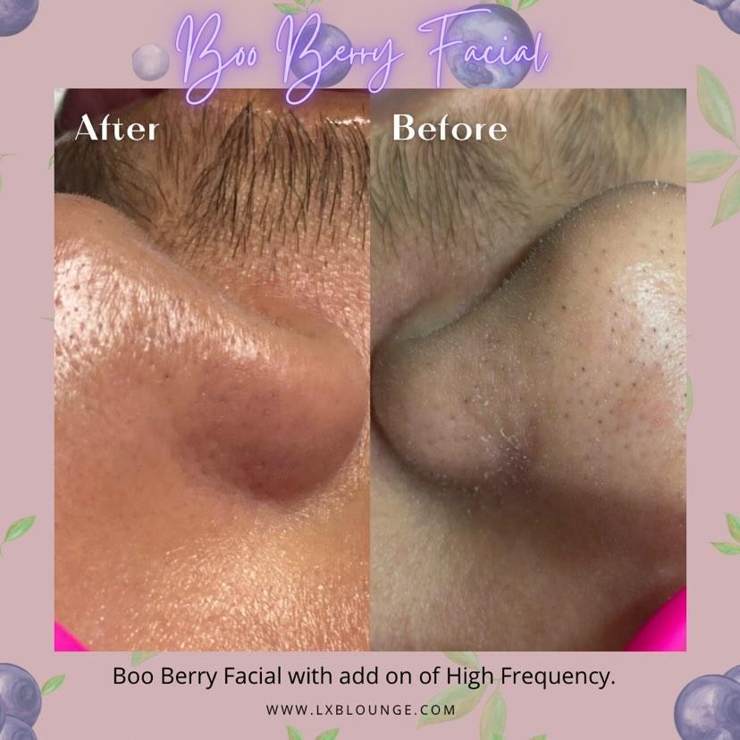 ZAQ Nova Ultrasonic Skin Scrubber Spatula – 33,000 Hz Deep Cleansing Device