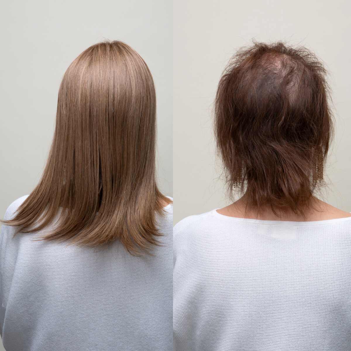 Topper de cabello humano Remy con encaje frontal Athena 14 XL French