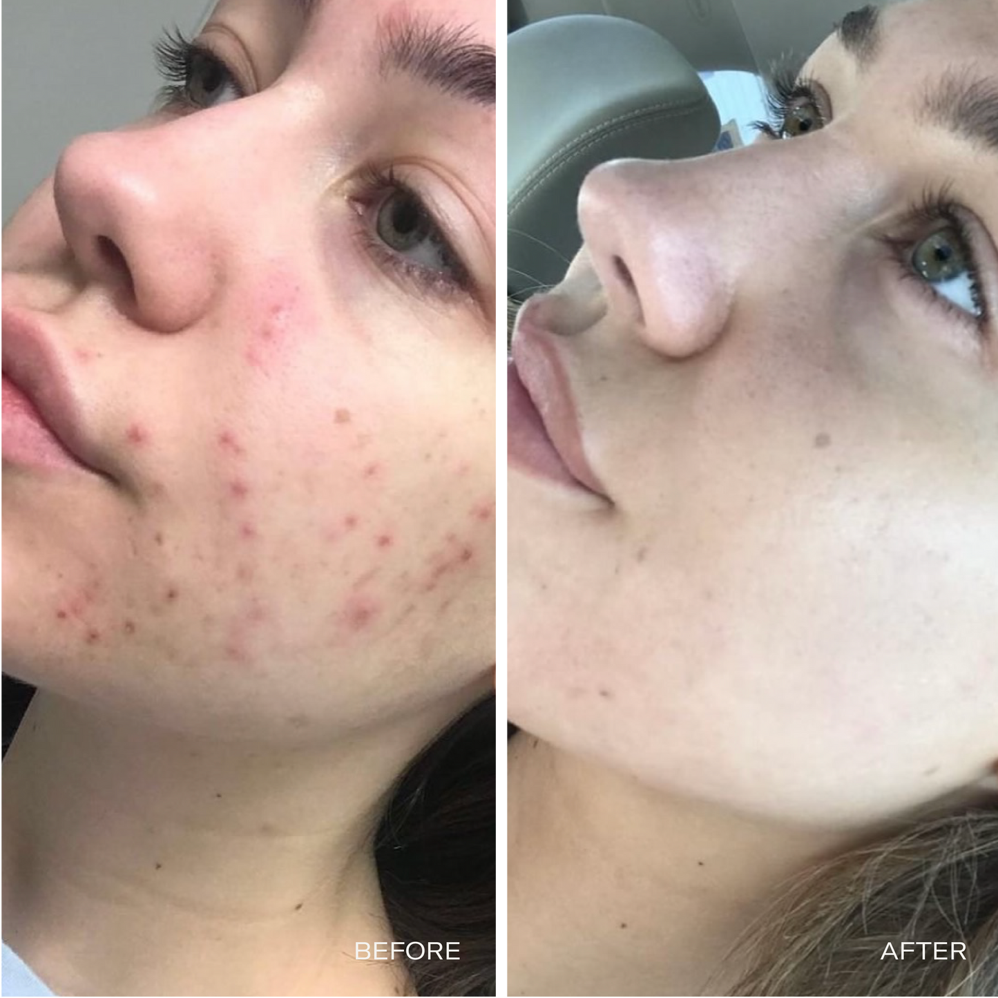 Oil-Cleansing Starter Kit