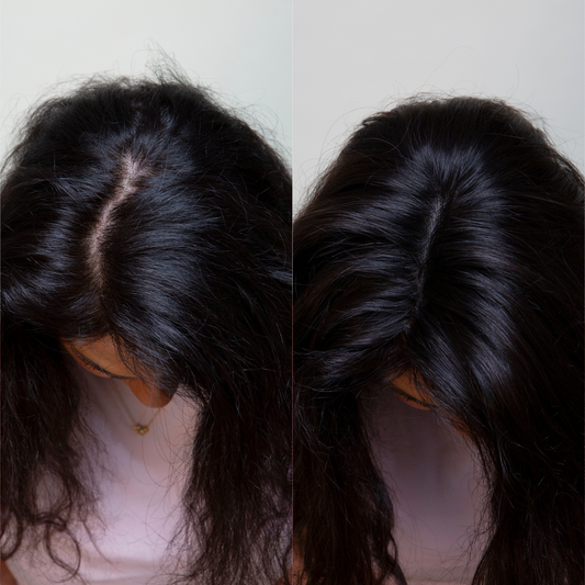 Clio 14 M | Remy Human Hair Topper (Hand-Tied)