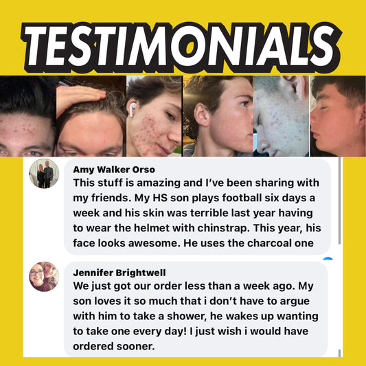 Lemonade Face Scrub (Light Acne)