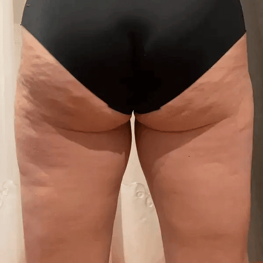 Gel anticelulítico Cheek Chic