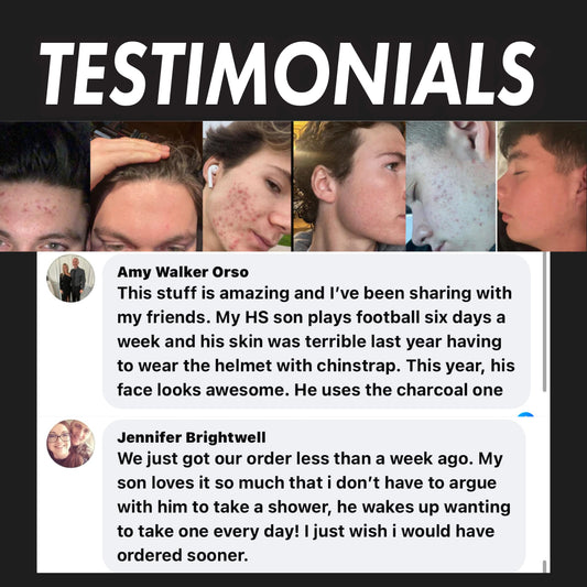 Gommage visage au charbon actif (acné sévère)