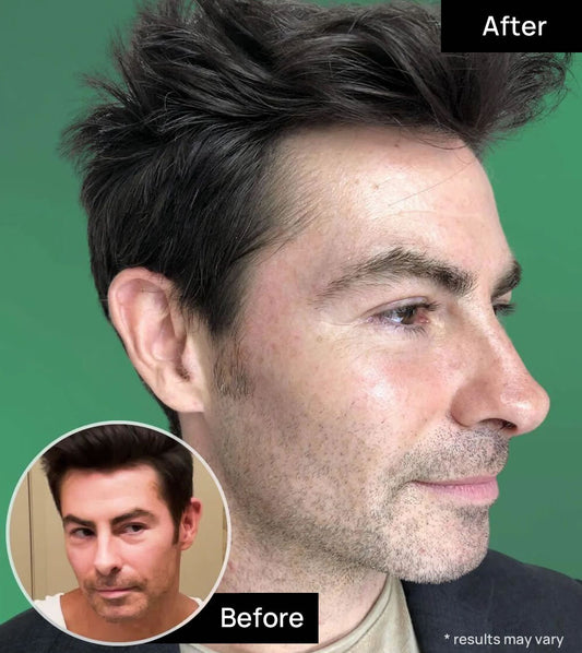 Cooling Under-Eye Stick