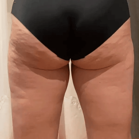 Cheek Chic Cellulite Gel | Daily Health & Beauty