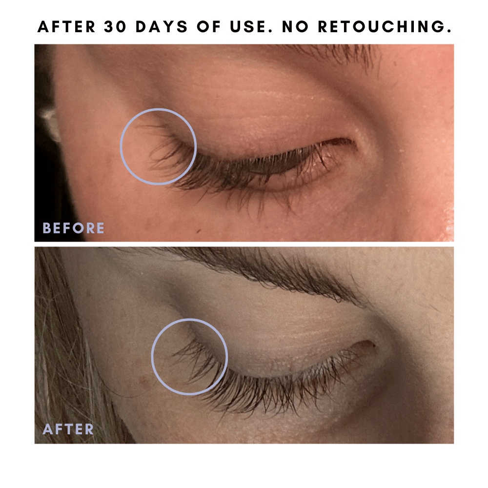 The Hair + Skin Boosting Bundle