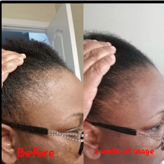 Edges and Temple Growth Cream