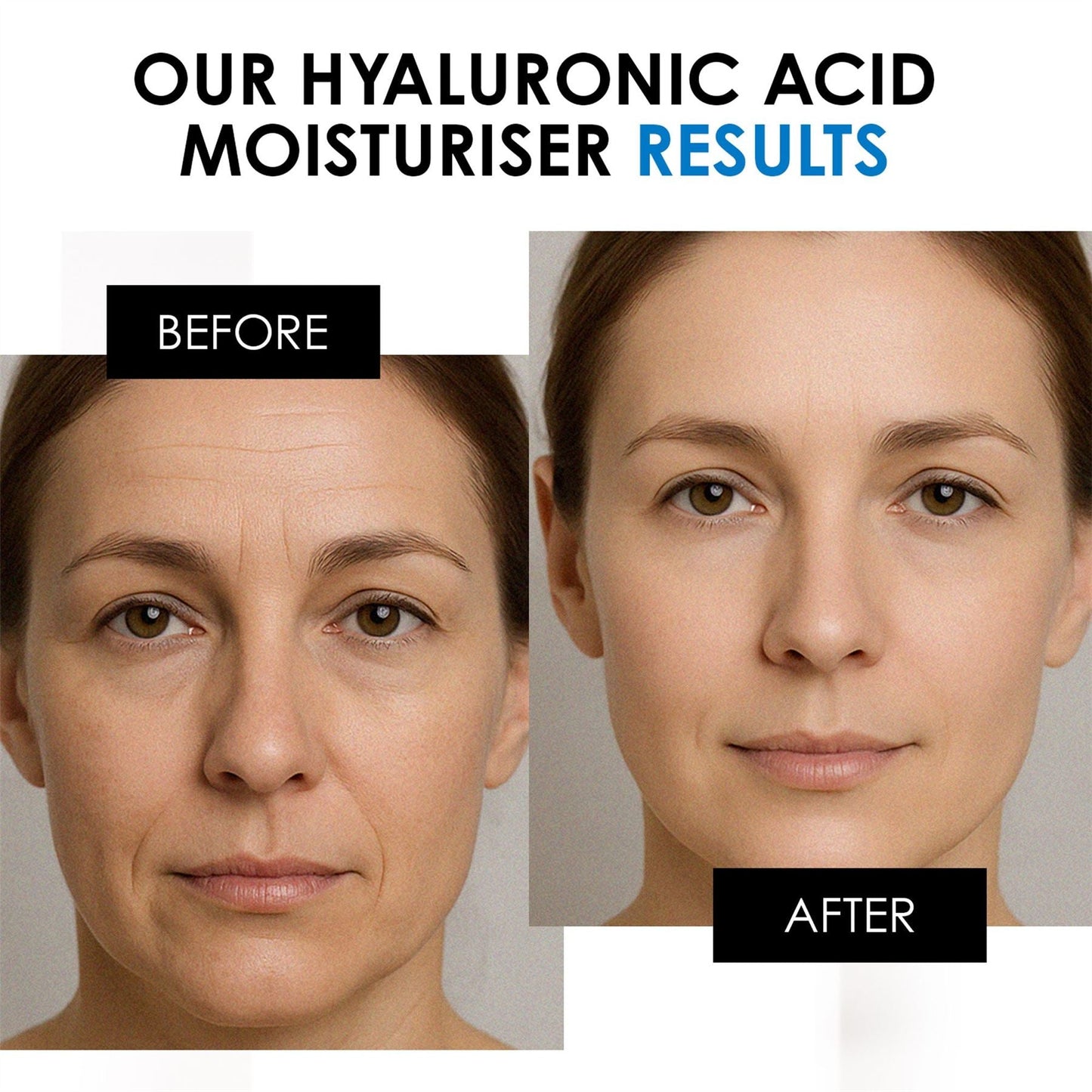 Hyaluronic Acid Day Moisturiser 50ml