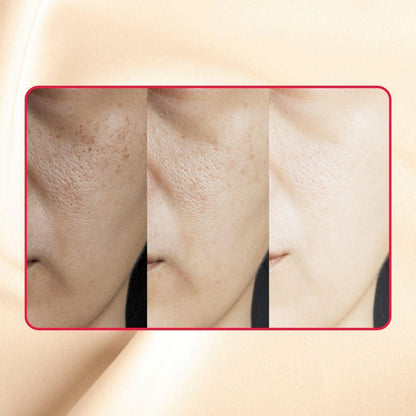 Thick As Thieves Pure Glycolic Acid Lactic Acid Extreme Gel Peel - 50ml