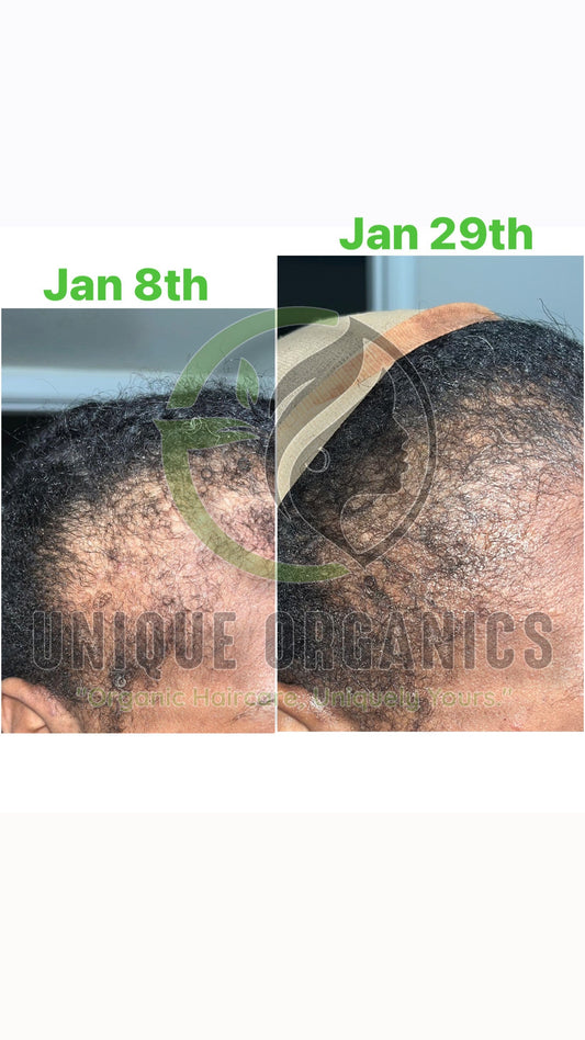 Root Strength Herbal Hair Oil | For Thinning Hair & Alopecia Care