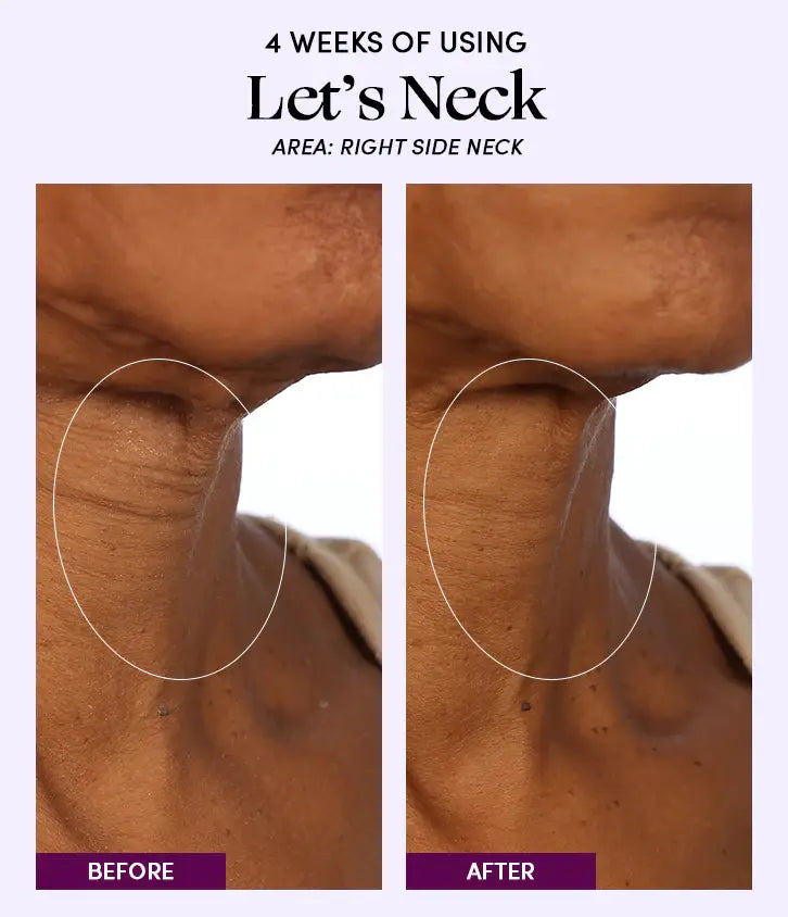 Womaness - Let's Neck - Neck Serum w/ Cooling Applicator: 1.7 oz