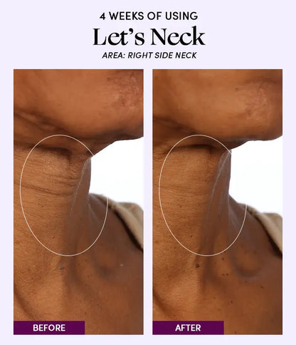 Womaness - Let's Neck - Neck Serum w/ Cooling Applicator: 1.7 oz
