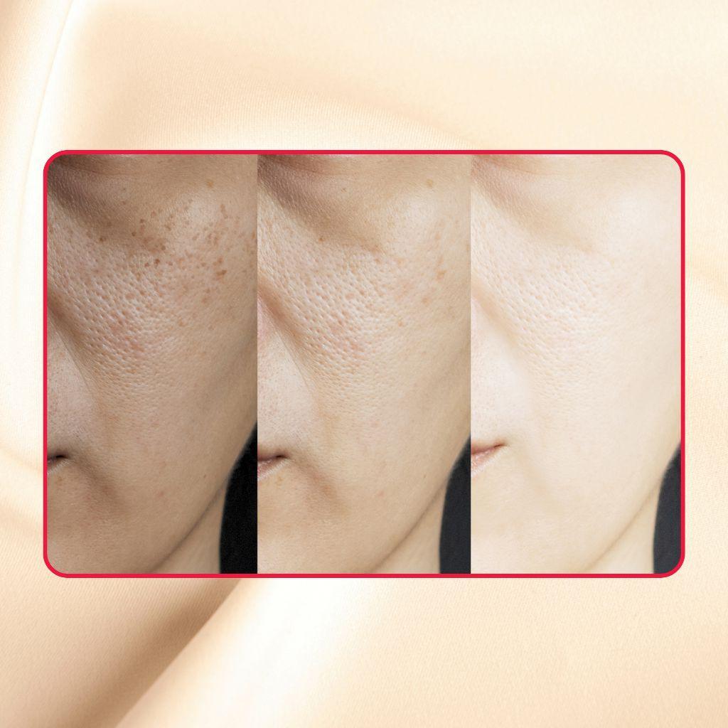 Gel exfoliante extremo con ácido glicólico puro y ácido láctico Thick As Thieves - 30 ml 