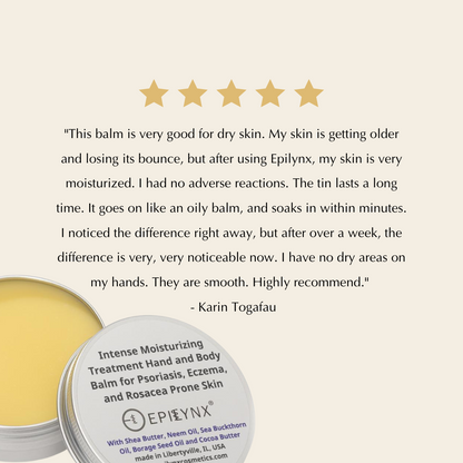 Intense Hydration Shea Butter Moisturizer for Dry Skin
