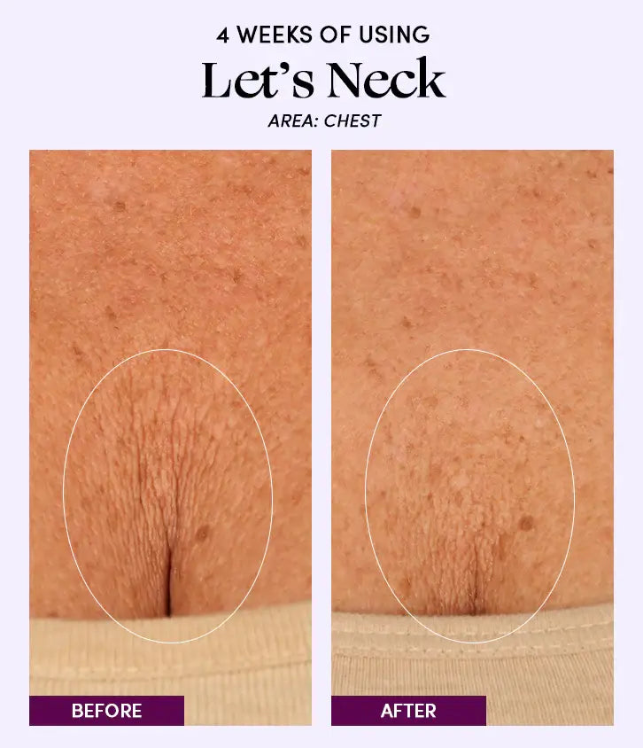 Womaness - Let's Neck - Neck Serum w/ Cooling Applicator: 1.7 oz