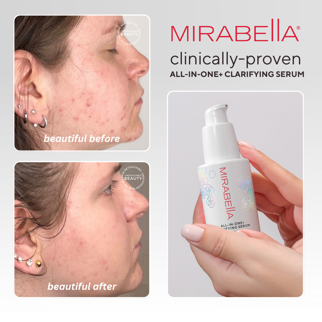 All-In-One Clarifying Serum