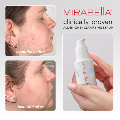 All-In-One Clarifying Serum