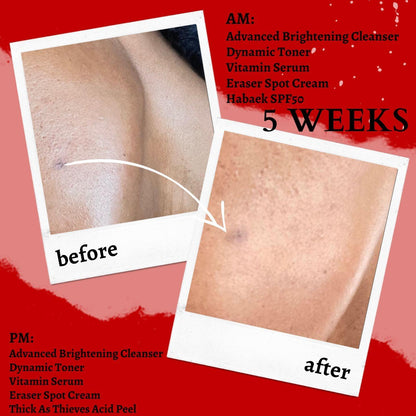 Gel exfoliante extremo con ácido glicólico puro y ácido láctico Thick As Thieves - 30 ml 