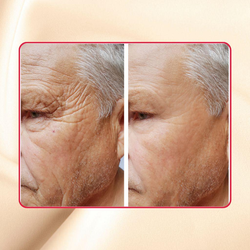 Gel exfoliante extremo con ácido glicólico puro y ácido láctico Thick As Thieves - 30 ml 