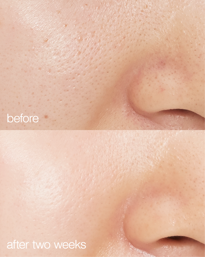 Biome Boost Cream Daily Moisturizer