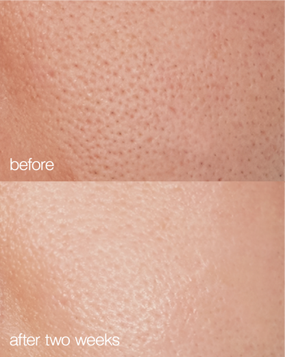 Biome Boost Cream Daily Moisturizer