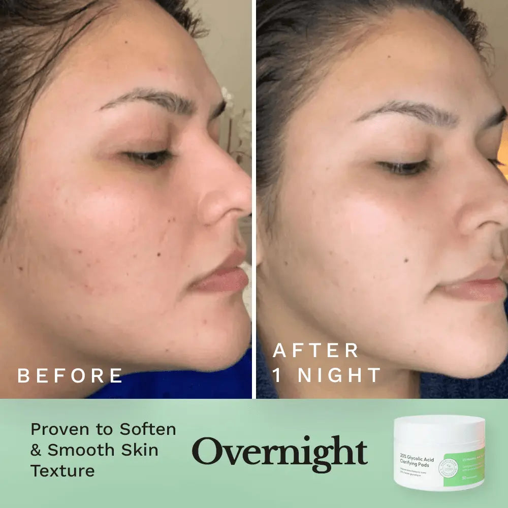 Glycolic Resurfacing Peel Pads