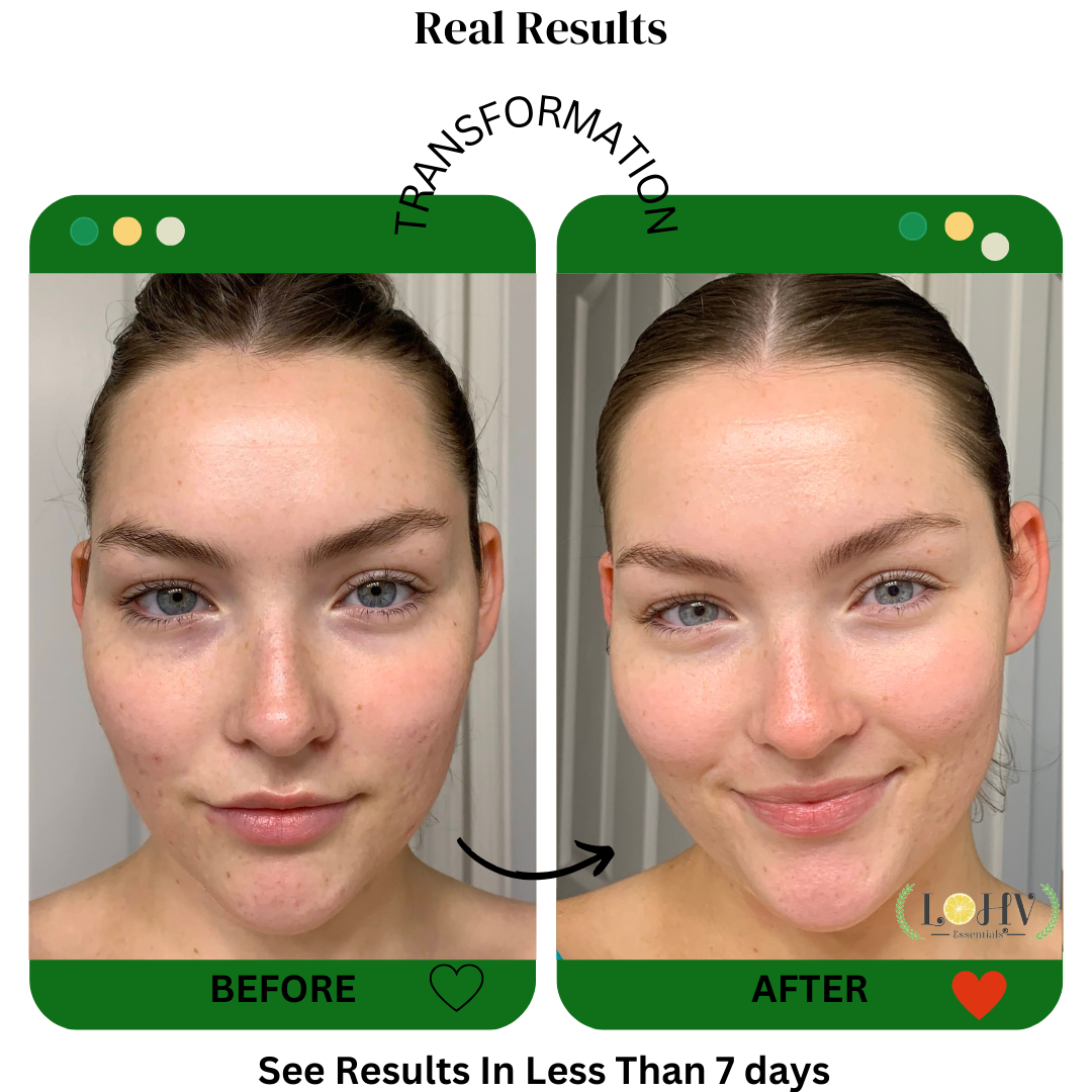 MASCARILLA FACIAL DE GELATINA REJUVENECEDORA 100% VEGANA PREMIUM Con Retinol + Cúrcuma + Aloe Vera + Ácido láctico + Hoja de Romero