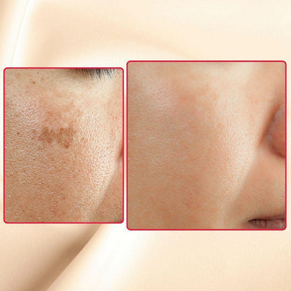 The Eraser Spot Cream | Dark Spot Correcting Moisturizer