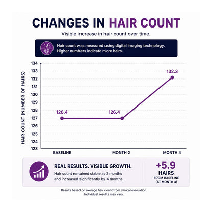 FOLIGAIN® Triple Action Complete Formula For Thinning Hair For Women with 10% TRIOXIDIL®