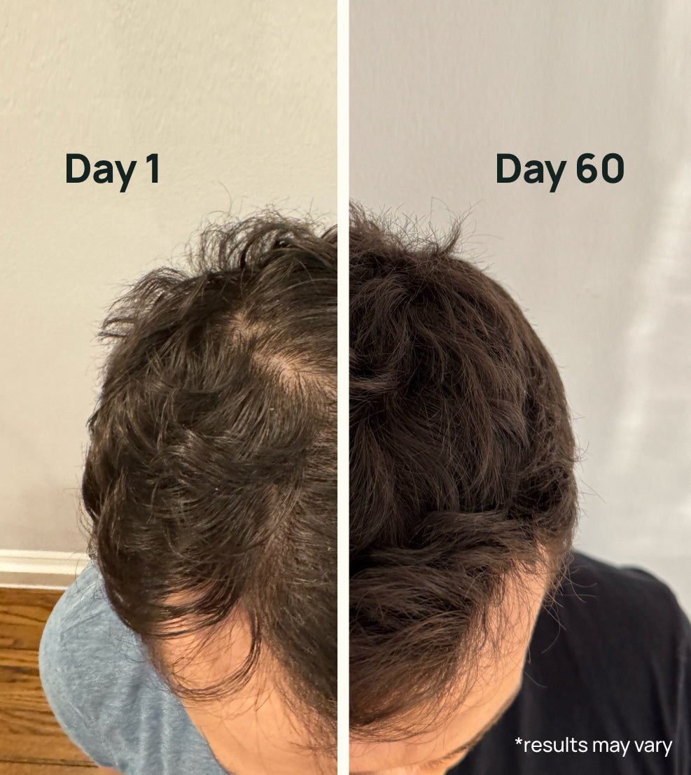 Hair Thickening Formula