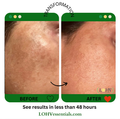 MASCARILLA FACIAL DE GELATINA REJUVENECEDORA 100% VEGANA PREMIUM Con Retinol + Cúrcuma + Aloe Vera + Ácido láctico + Hoja de Romero