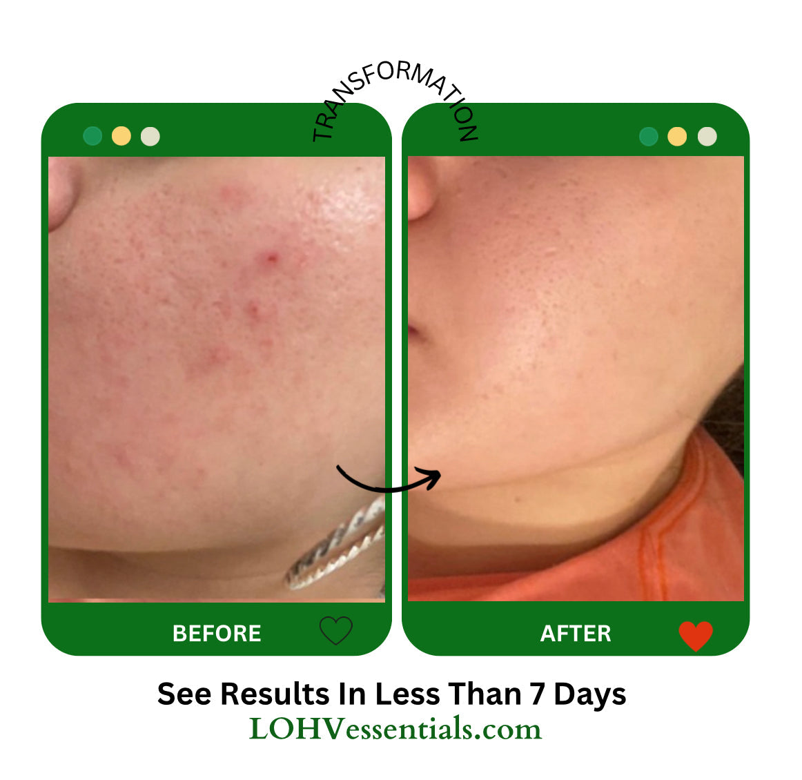 MASCARILLA FACIAL DE GELATINA REJUVENECEDORA 100% VEGANA PREMIUM Con Retinol + Cúrcuma + Aloe Vera + Ácido láctico + Hoja de Romero