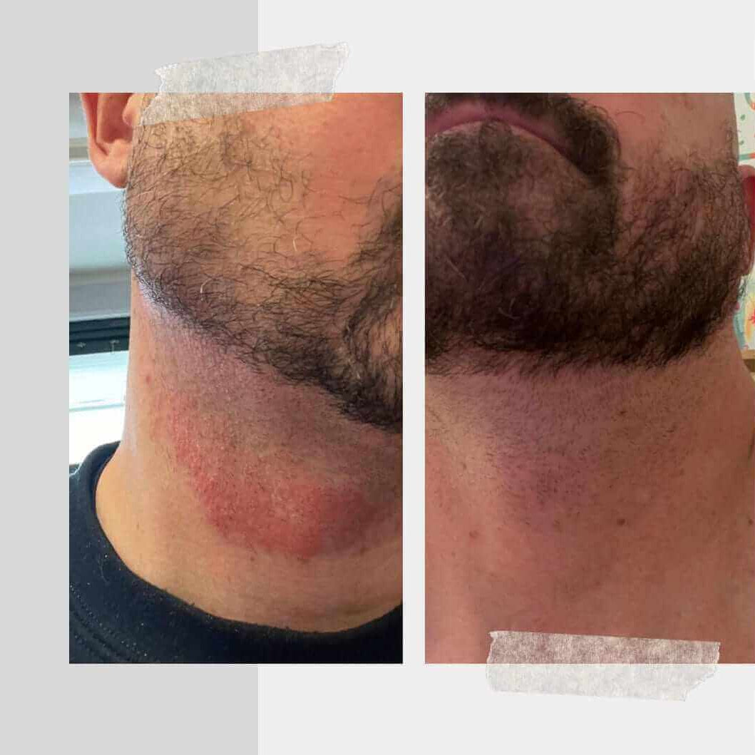 Manteca hidratante facial sin aceites esenciales