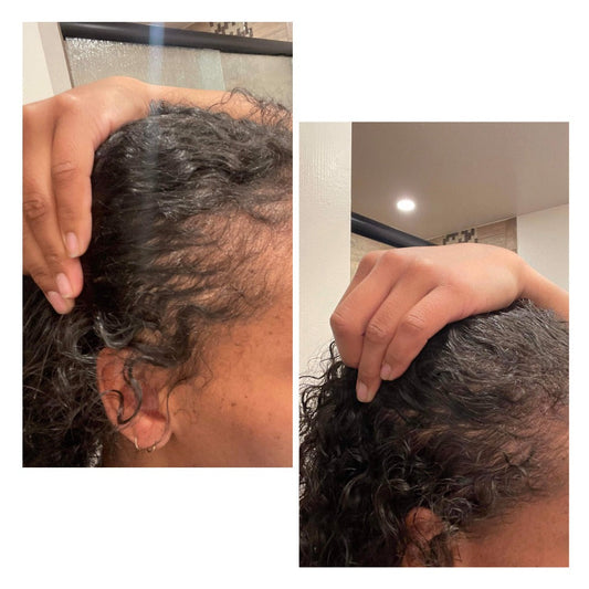Root Strength Herbal Hair Oil | For Thinning Hair & Alopecia Care