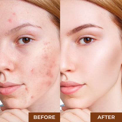 Best Pore Minimizing Primer by Prolux