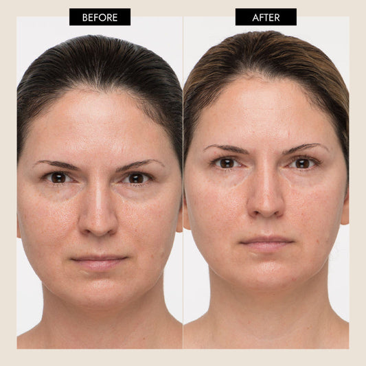 MyoLift™ Mini Spa Starter Kit