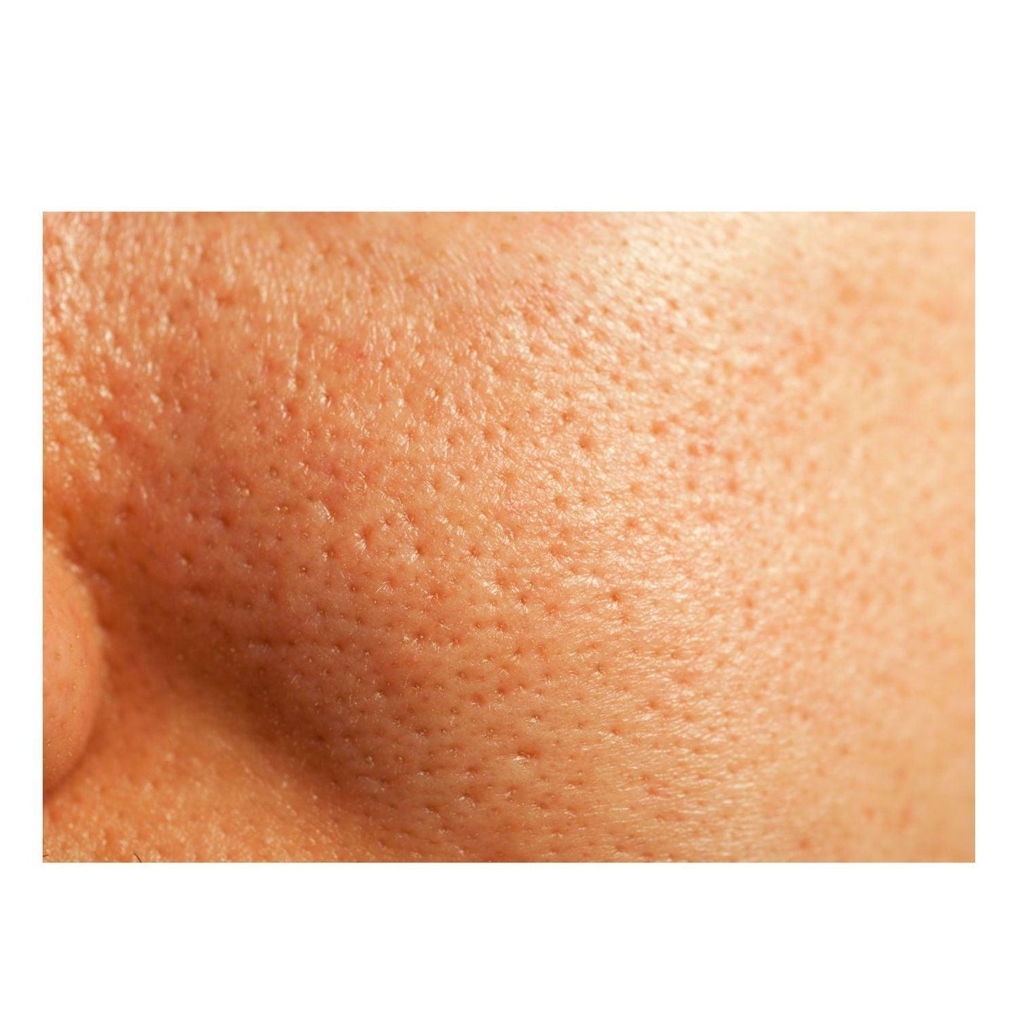 Gel exfoliante extremo con ácido glicólico puro y ácido láctico Thick As Thieves - 30 ml 