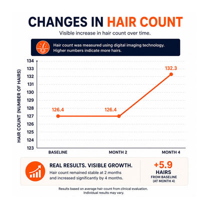 FOLIGAIN® Triple Action Shampoo For Thinning Hair For Men with 2% TRIOXIDIL®