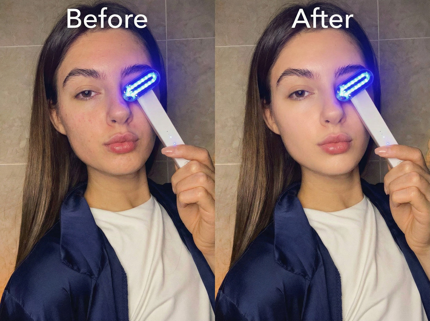 ZAQ Zayn 2.0 — 6-in-1 LED & Microcurrent Facial Wand