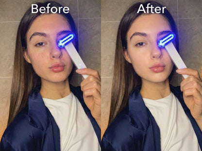 ZAQ Zayn 2.0 — 6-in-1 LED & Microcurrent Facial Wand