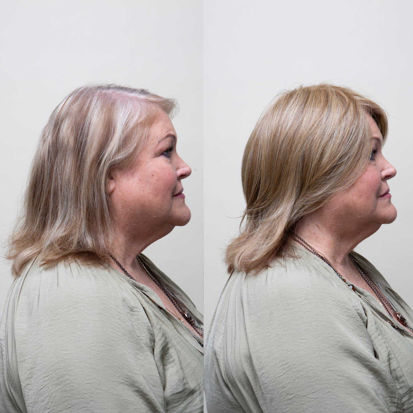 Clio 8 L | Hand-Tied Synthetic Hair Topper (Heat-Friendly)