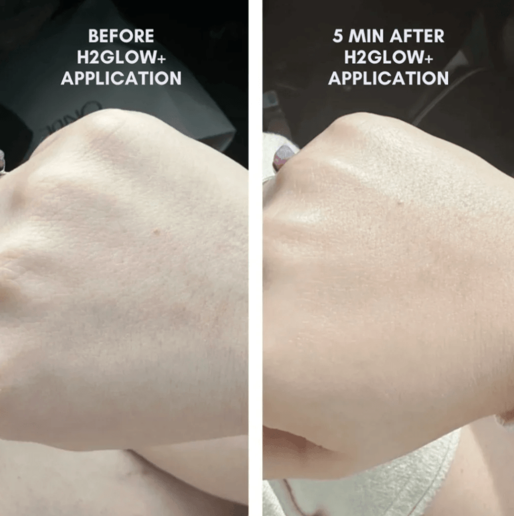 The Complete Skincare Collection