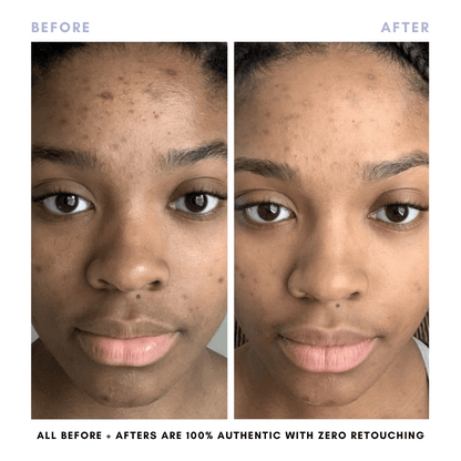 The Complete Skincare Collection