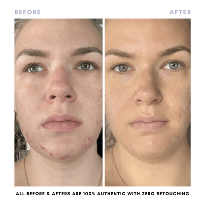 The Complete Skincare Collection