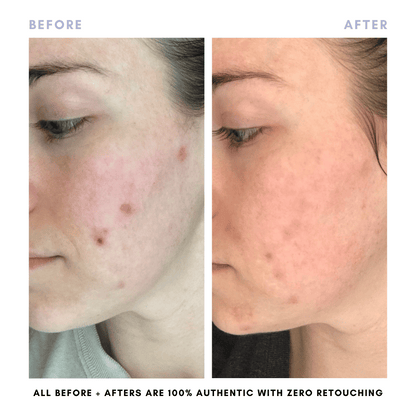 The Complete Skincare Collection