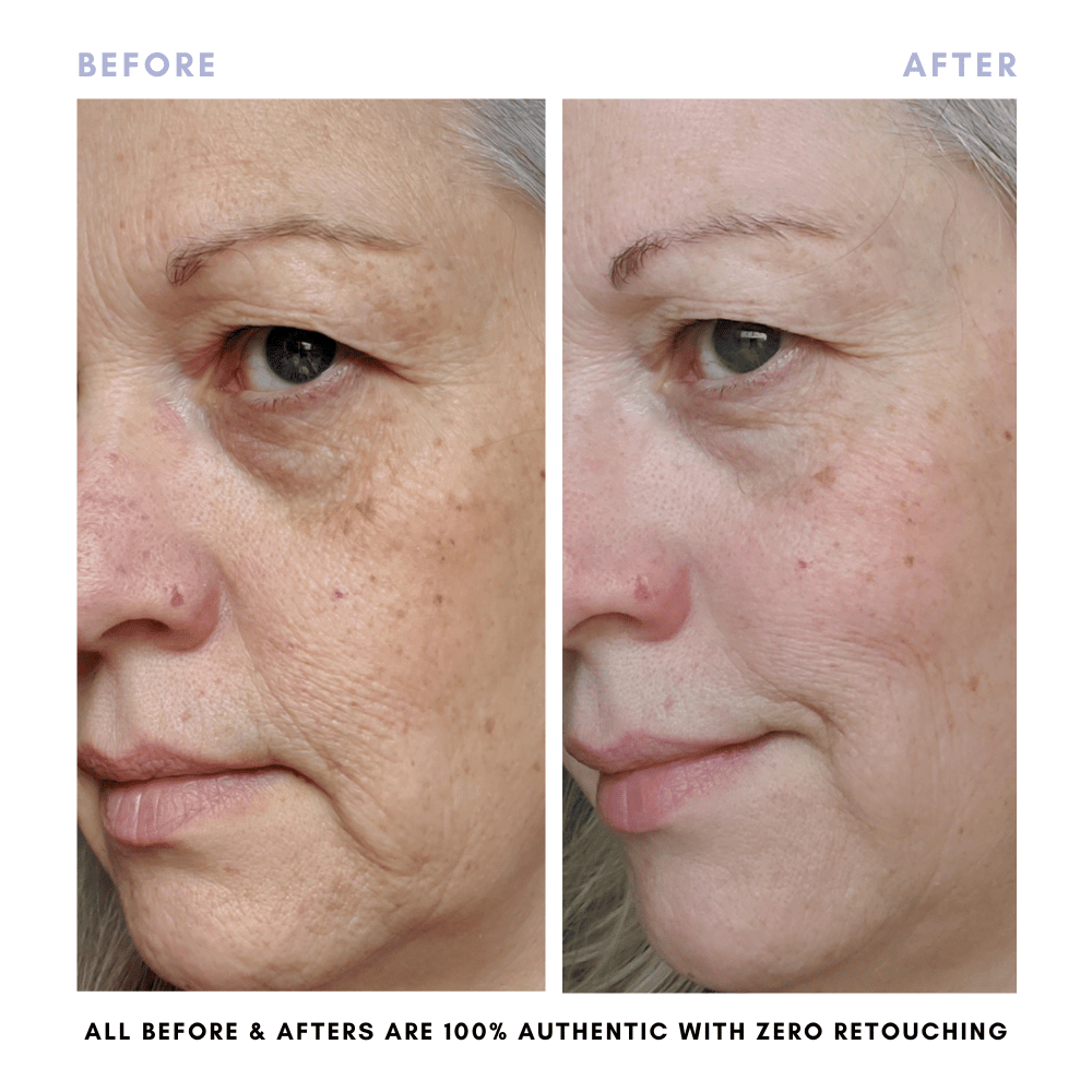 The Revive + Restore Skin Set | Anti-Aging + Skin Barrier Support Essential