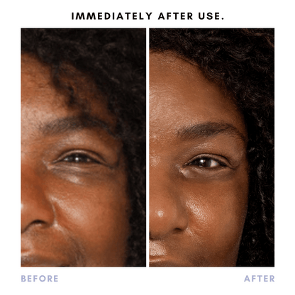 Tratamiento bioactivo para ojos Triple Shot 3 en 1