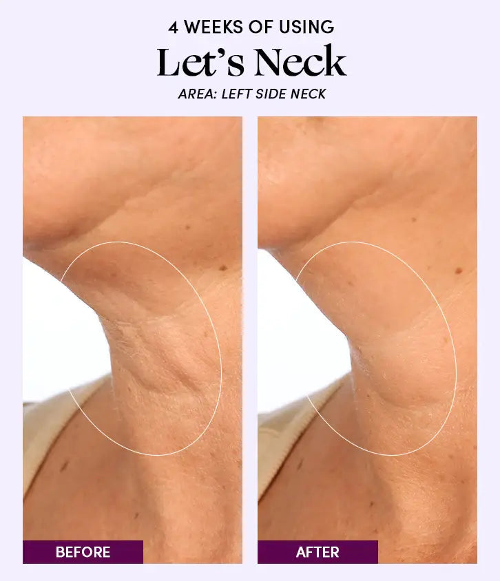 Womaness - Let's Neck - Neck Serum w/ Cooling Applicator: 1.7 oz