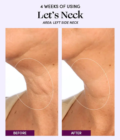 Womaness - Let's Neck - Neck Serum w/ Cooling Applicator: 1.7 oz