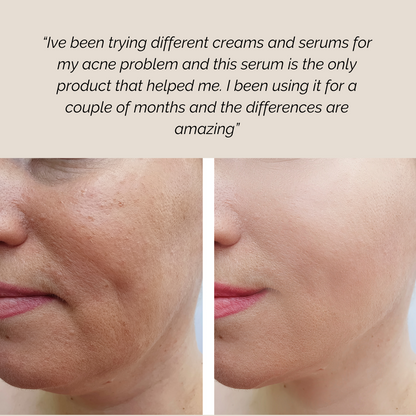 Botanical Face Serum